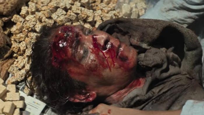 Dhurandhar movie: a close-up of a man with a gory head wound