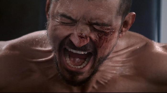 The Cut: A male boxer shouts with a cut eye during a fight
