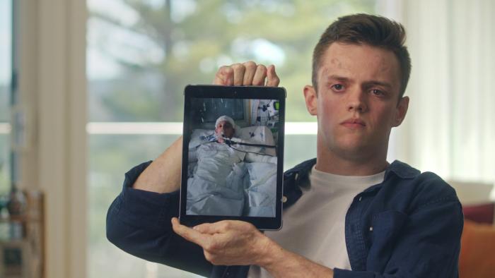 Australian tourist Jesse Langford shows image of injuries from Whakaari/White Island volcano eruption.