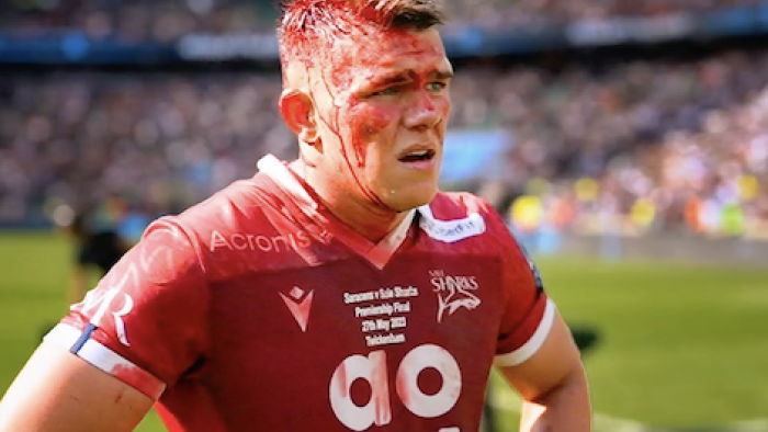 Mud, Sweat and Tears screenshot 1: Salacer player with maroon away uniform and bloody head. 