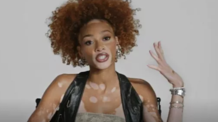 The CEO Club TV show screenshot 2: Winnie Harlow talks into the camera in casual wear. 