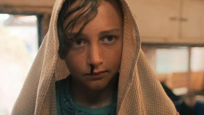 The Chosen One TV show screenshot 1: Jodie is shown in close-up, with a brown blanket over his head. His nose is bleeding. 