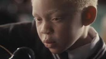 Can You See Us?: A boy with albinism closeup