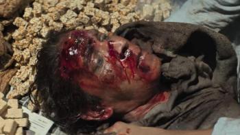 Dhurandhar movie: a close-up of a man with a gory head wound