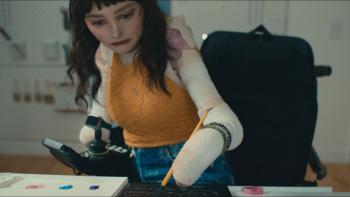 Matter of Time: Deanna, who has EB, paints.