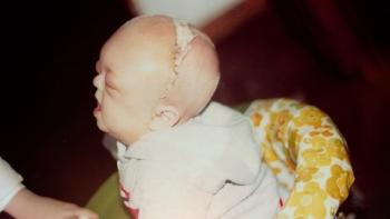 Standout: The Ben Kjar Story movie: A picture of Ben as a baby, healing after a surgery