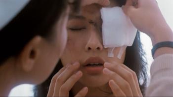 The Killer: Sally Yeh has eye dressing removed