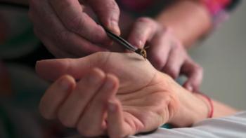 (Un)Well TV Show: Someone gets voluntarily stung by a bee