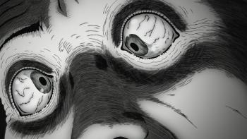 Uzumaki TV show screenshot 4: Close-up of a man's blood-shot eyes with pupils facing in different directions.